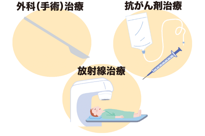 がんの三大治療 外科(手術)治療、抗がん剤治療、放射線治療